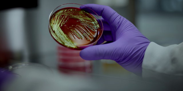 gloved hand holding a petri dish